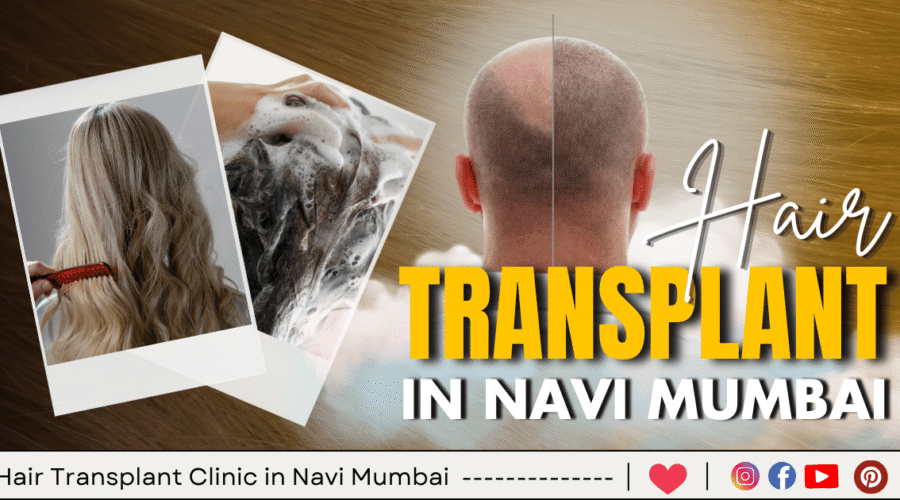 15 Best Hair Transplant Clinic in Navi Mumbai