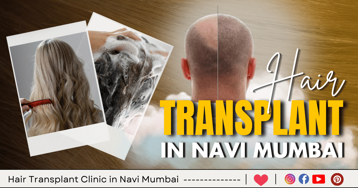 15 Best Hair Transplant Clinic in Navi Mumbai