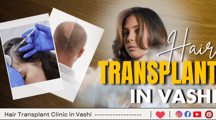 3 Best Hair Transplant Clinic in Vashi – Navi Mumbai